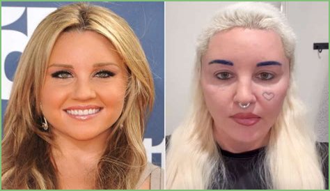 Aly Michalka Plastic Surgery Before and After